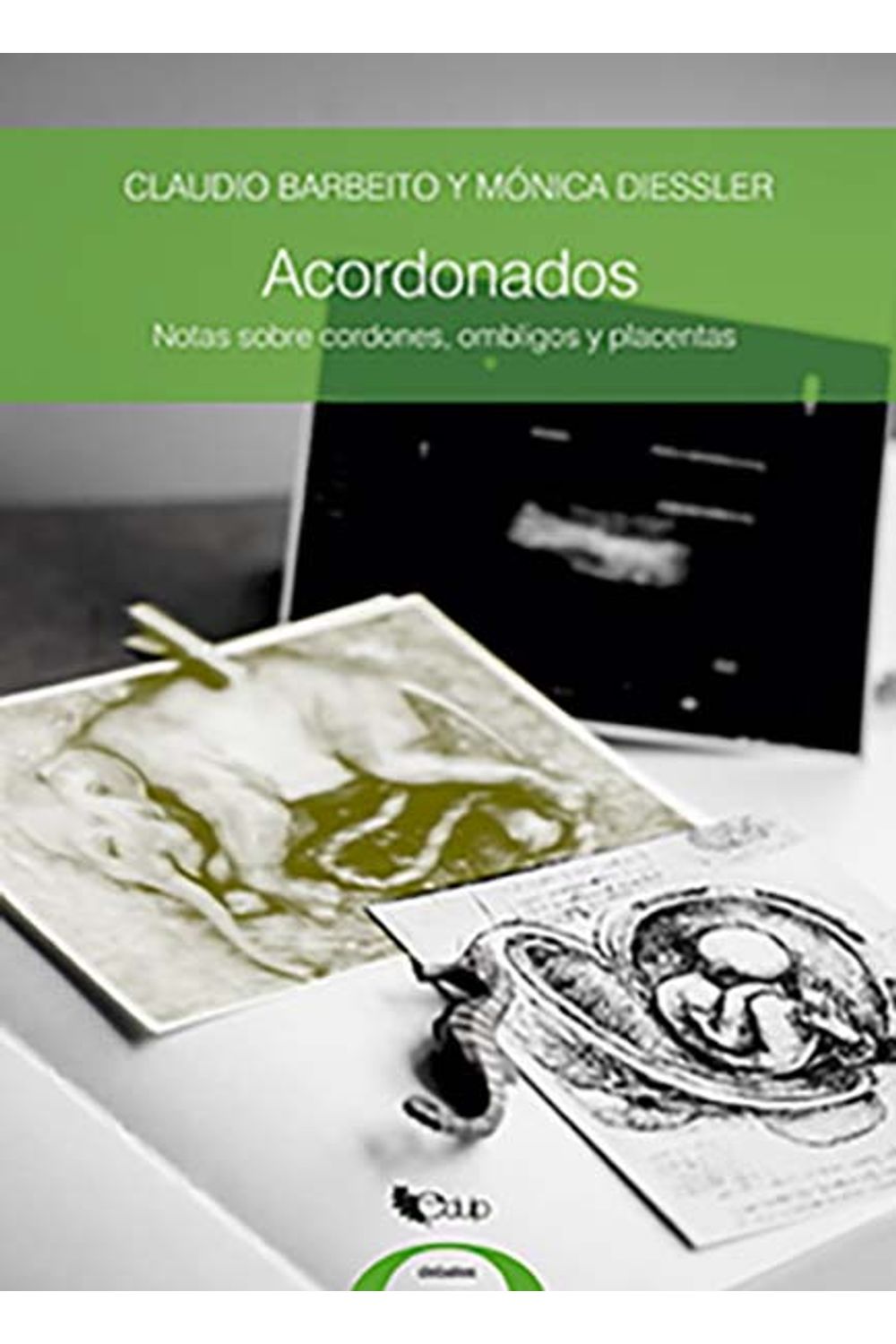 Acordonados-Notas-sobre-cordones-ombligos-y-placentas