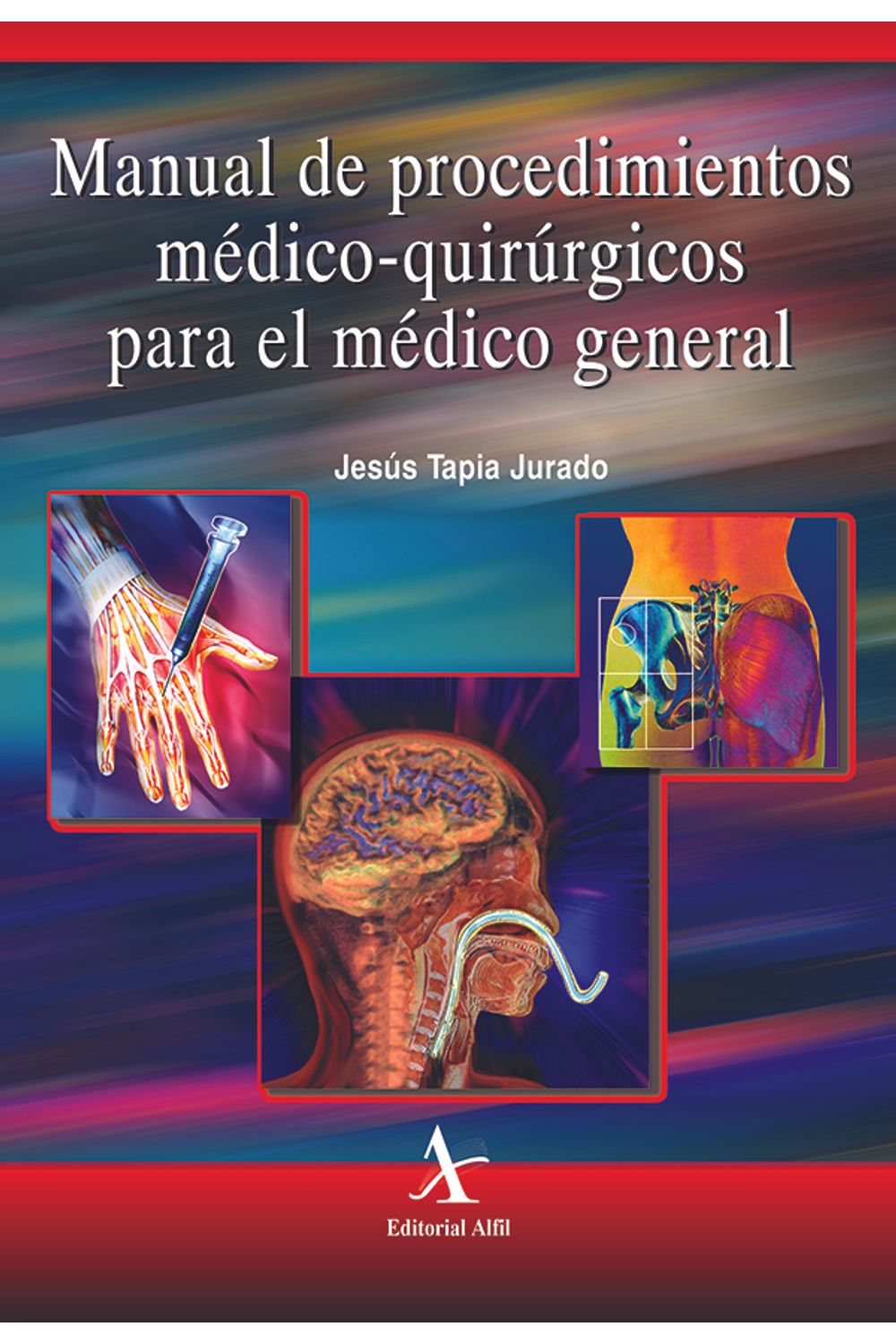 bm-manual-de-procedimientos-medicoquirurgicos-para-el-medico-general-editorial-alfil-9789687620459